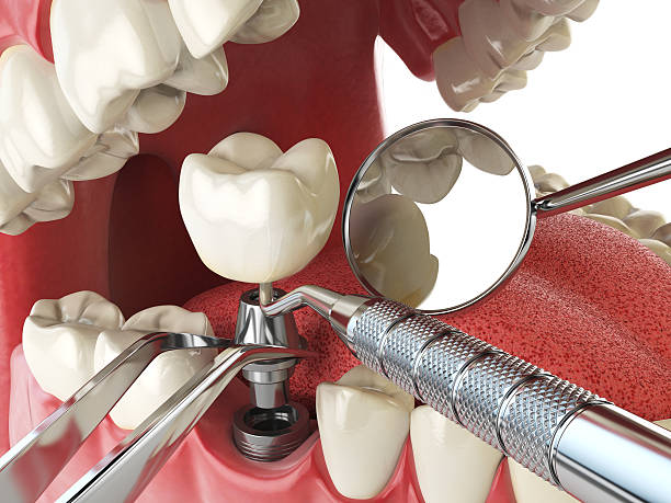 Best Emergency Dental Services for Seniors in Columbia, MD
