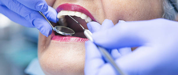 Best Emergency Dentist for Knocked-Out Tooth in Columbia, MD